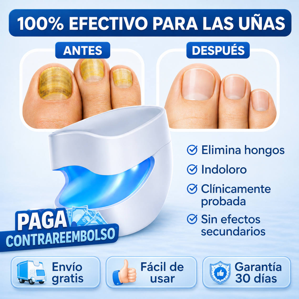 NailLaser Pro Láser para Hongos en las Uñas