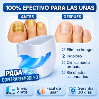 NailLaser Pro Láser para Hongos en las Uñas