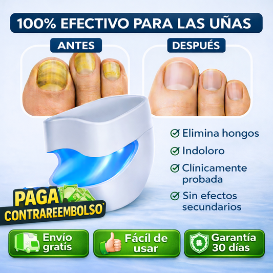 Dispositivo Láser para Hongos en las Uñas